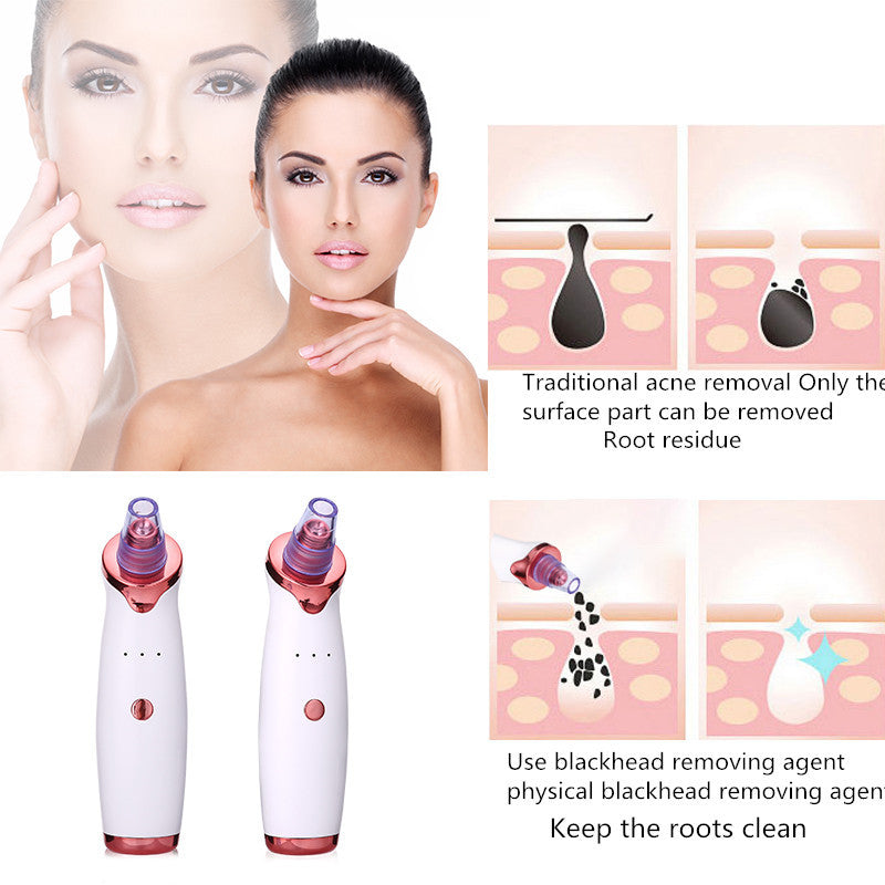 Radiance Pro
