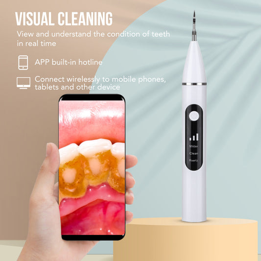 Visual Ultrasonic Dental Scaler – Tartar Removal & Whitening Tool with LED Display